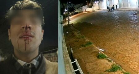Vítima apanhou de 10 rapazes por homofobia em frente ao Armazém Cultural