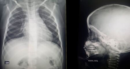 Falta de raio-x e remédios básicos expõe falhas em unidades de pronto atendimento da Capital