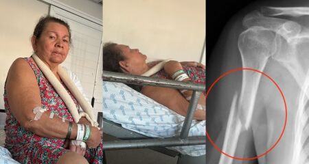 Família denuncia demora no atendimento e teme complicações devido à idade e condições de saúde da idosa