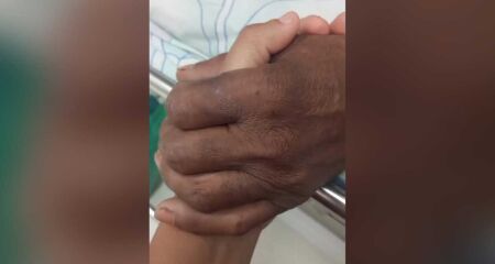 Ele segue internado no posto de saúde