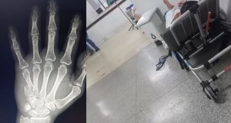 Pacientes aguardam no corredor da Santa Casa