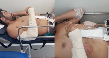 Wesley sofreu grave acidente no dia 11 de julho em Campo Grande; quadro piorou após grave infecção