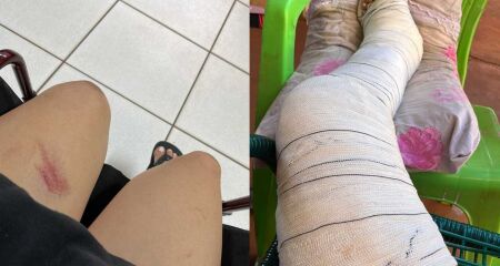 Vitória Christina aguarda há dois dias transferência para cirurgia na Santa Casa