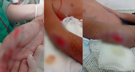 Família denuncia sumiço de ortopedista e reclama de más condições e constrangimento no hospital