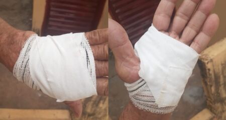 Médica pediu desculpas à família por falta de material para costurar corte de idosa no Coronel Antonino