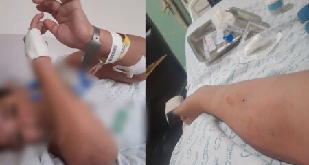 Amanda quase morreu após ter uma infecção grave