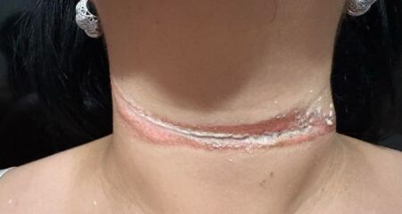 Tacielly conduzia uma bicicleta elétrica pela Rua Eurídice Chaga Cruz quando o incidente ocorreu