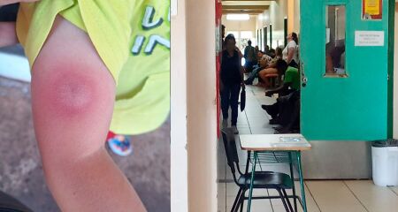 Mãe procura Upa após seu filho ser picado por aranha e tem que aguardar 3 horas