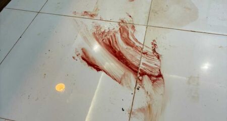 A dupla chegou a ser socorrida, mas não resistiu e morreu no hospital da cidade 