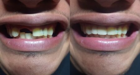 Profissional já atendeu mais de 50 pessoas em menos de um mês e aposta no acolhimento como diferencial