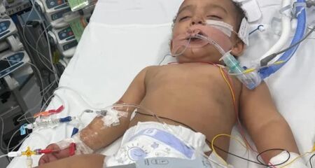 Bebê de 1 ano e 8 meses teve queimaduras graves na boca e uma parada cardíaca depois de confundir produto tóxico com leite