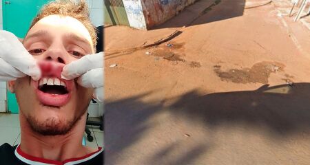 Homem é agredido após desentendimento no trânsito