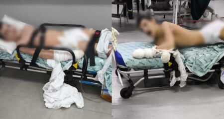 Jovem está sem o tratamento adequado, o que causa internações constantes