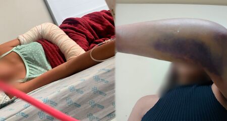 Mesmo com encaminhamento de vaga zero, menor segue internada sem previsão de procedimento