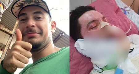 Secretária de saúde diz que ele "não é o único paciente do Estado" e não pode agir fora das normas