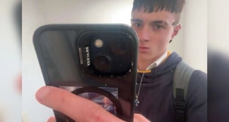 Lee Ray King, da Nova Zelândia, usou cigarro eletrônico por três anos. Aos 17 anos, médicos retiraram vários pedaços mortos do pulmão dele