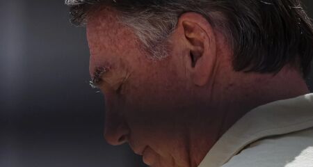 Advogados solicitaram que o ex-presidente possa ficar no hospital pelo "tempo necessário" para ter uma recuperação adequada