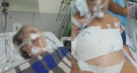 Idosa permanece entubada no CTI à espera de procedimento considerado urgente