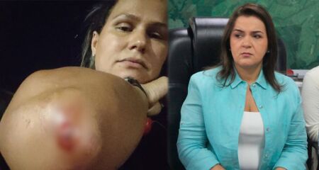 A Prefeitura de Campo Grande também será processada