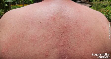 Idoso é atacado por enxame de abelhas em quintal de casa