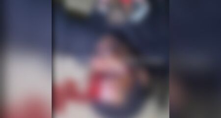 Vítima foi socorrida inconsciente e levada ao hospital com sangramento no rosto