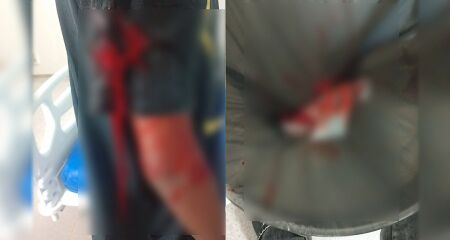 Mãe fica preocupada após cirurgia indevida