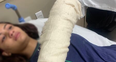 Agredida na escola, menina de 13 anos espera 30 dias por cirurgia e vai ficar com sequelas