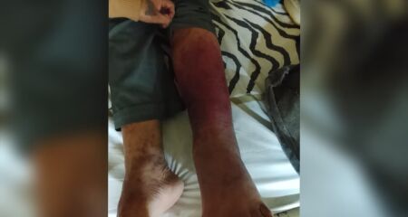 Internado há uma semana, Ramão não consegue vaga nem medicamento para tratar problema em Campo Grande