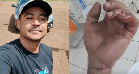 Fam&iacute;lia corre contra o tempo para que mec&acirc;nico recupere movimentos da m&atilde;o