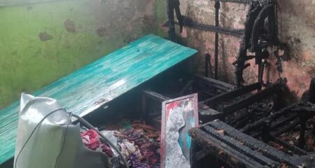 Crian&ccedil;a encontra-se internada, com cerca de 50% do corpo atingido por queimaduras de segundo grau. Caso foi registrado no Maranh&atilde;o