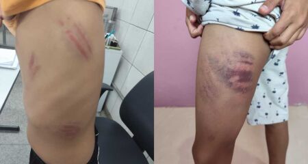 Pais do agressor teriam participado da viol&ecirc;ncia; v&iacute;tima precisou ser internada devido &agrave;s agress&otilde;es