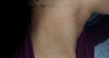 Adolescente de 16 anos sofre tentativa de estrangulamento e foge para escapar do namorado 