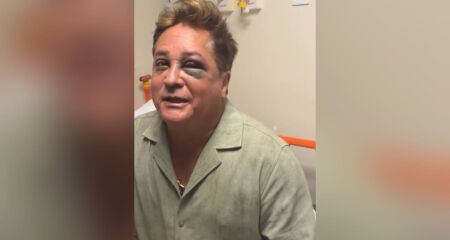Cantor diz que machucou o ''chifre''