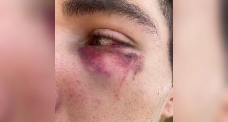 Furto aconteceu h&aacute; uma semana e trabalhador ainda n&atilde;o conseguiu recuperar ve&iacute;culo