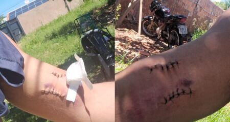 Baleado no bra&ccedil;o, homem contesta vers&atilde;o oficial e diz que foi cobrar d&iacute;vida antes de ser atacado