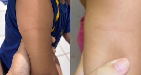 Marca no bra&ccedil;o direito fez m&atilde;e desconfiar e acionar autoridades  