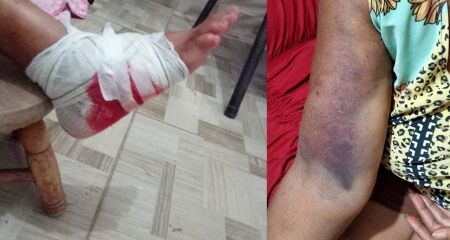 Al&eacute;m da falta de medicamentos para dor, a paciente demorou mais de uma semana para receber o diagn&oacute;stico correto