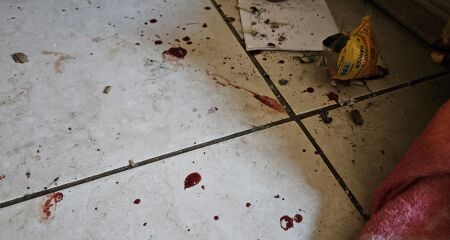 O estado avan&ccedil;ado de decomposi&ccedil;&atilde;o impossibilitou a identifica&ccedil;&atilde;o de poss&iacute;veis marcas de viol&ecirc;ncia