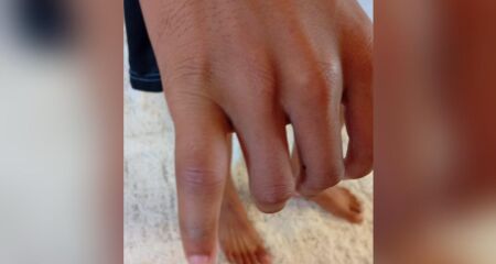 O adolescente retornou para casa depois de horas sem atendimento 