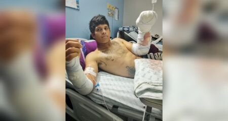 Al&eacute;m da dor e da recupera&ccedil;&atilde;o f&iacute;sica, Patrick tamb&eacute;m vive a preocupa&ccedil;&atilde;o com a possibilidade de perder os movimentos dos dedos