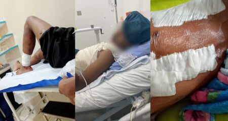 A m&atilde;e precisou parar de trabalhar para acompanh&aacute;-lo no hospital