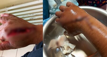 O trabalhador detalhou que o m&eacute;dico n&atilde;o passou pelo seu quarto, n&atilde;o deixando receita ou novas orienta&ccedil;&otilde;es para medica&ccedil;&atilde;o