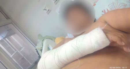 Ele foi internado ap&oacute;s cair de moto e quebrar o bra&ccedil;o