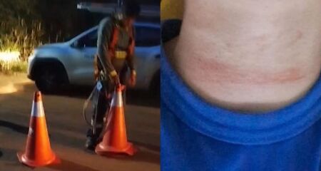 O menor seguia de bicicleta pelo bairro &agrave; noite quando sofreu o acidente