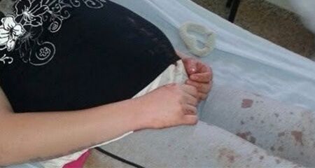 A pedra atingiu diretamente o olho direito da m&atilde;e