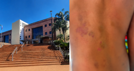 O companheiro da guardi&atilde; est&aacute; sendo investigado por agress&otilde;es contra a crian&ccedil;a de seis anos