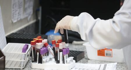 O projeto prevê a contratação de uma empresa especializada para prestar serviços de análises clínicas, anatomia patológica e citopatologia aos municípios consorciados