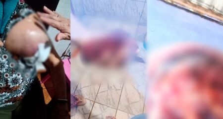 O estado de saúde dela tem piorado dia após dia e, segundo a família, o ferimento chegou a 'vazar'