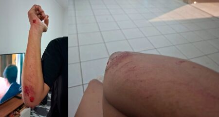 Rua localizada dentro de condomínio seria de responsabilidade pública, diz síndico do condomínio
