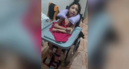 Menina com microcefalia aguardava procedimento desde 2022 e agora sente mais conforto e menos dor no dia a dia